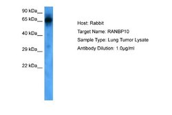 RANBP10 Rabbit anti-Human, Polyclonal, Novus Biologicals 0.1 mL | Buy Online | Novus Biologicals | Fisher Scientific